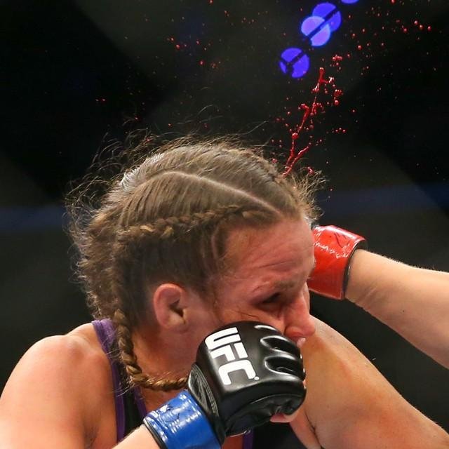 Fotos das lutas e bastidores do UFC 180, na Cidade do Mxico - Leslie Smith sofreu duro golpe de Jessica Eye, teve um grave corte na orelha esquerda, e foi derrotada por interrupo dos mdicos
