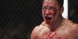 Michael Bisping arrasou Cung le no UFC em Macau, em agosto. Vietnamita deixou o octgono com rosto bastante castigado