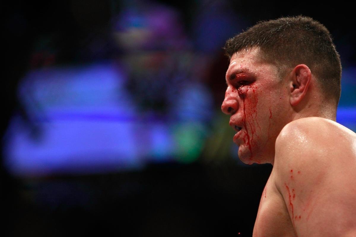 Em retorno ao octgono depois de 13 afastado por fratura na perna esquerda, Anderson Silva venceu Nick Diaz por deciso unnime, na luta principal do UFC 183, na MGM Grand Garden, em Las Vegas