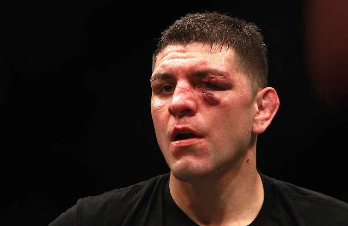 Em retorno ao octgono depois de 13 afastado por fratura na perna esquerda, Anderson Silva venceu Nick Diaz por deciso unnime, na luta principal do UFC 183, na MGM Grand Garden, em Las Vegas