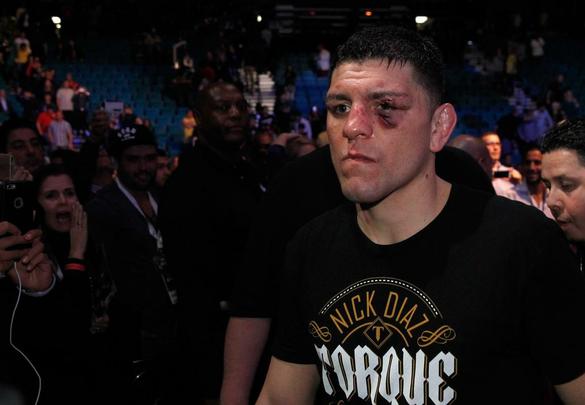 Em retorno ao octógono depois de 13 afastado por fratura na perna esquerda, Anderson Silva venceu Nick Diaz por decisão unânime, na luta principal do UFC 183, na MGM Grand Garden, em Las Vegas