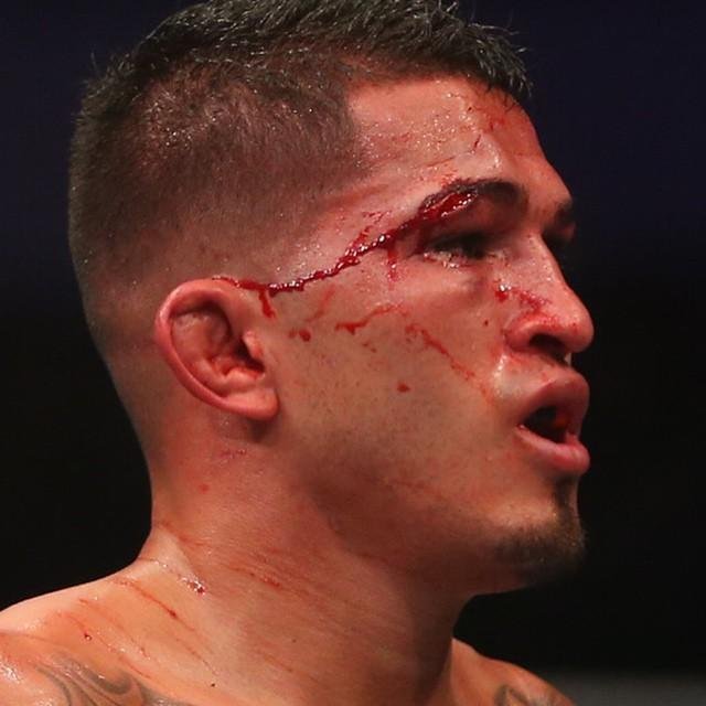 Imagens das lutas e bastidores do UFC 185, em Dallas - Rafael dos Anjos (bermuda azul) venceu Anthony Pettis por deciso unnime e conquistou o cinturo dos leves
