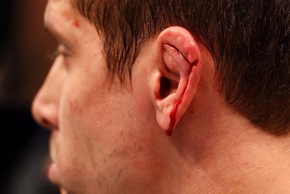 Imagens das lutas e dos bastidores do UFC on FOX 15, em Newark - Diego Brando (bermuda azul) venceu Jimmy Hettes por nocaute tcnico (interrupo mdica) 