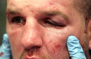 Em 6 de agosto de 2011, Gustafsson enfrentou o perigoso Matt Hamill e nocauteou o adversrio no segundo round com socos e cotoveladas