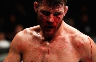 Spider voltou ao UFC com rev�s. Brasileiro chegou a derrubar Bisping com uma joelhada, achou que tinha vencido por nocaute, mas round havia encerrado. No fim, brasileiro acabou perdendo luta por pontos