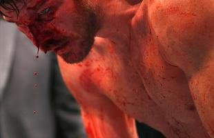 Spider voltou ao UFC com rev�s. Brasileiro chegou a derrubar Bisping com uma joelhada, achou que tinha vencido por nocaute, mas round havia encerrado. No fim, brasileiro acabou perdendo luta por pontos 