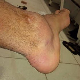 Divulga��o