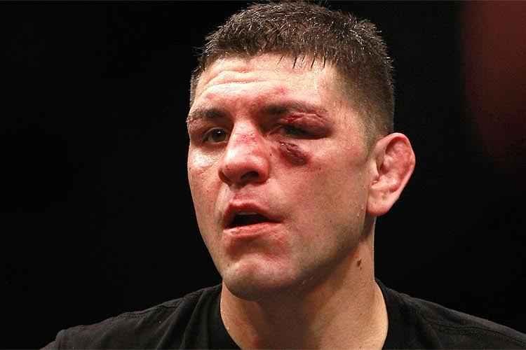 Steve Marcus/AFP PHOTO